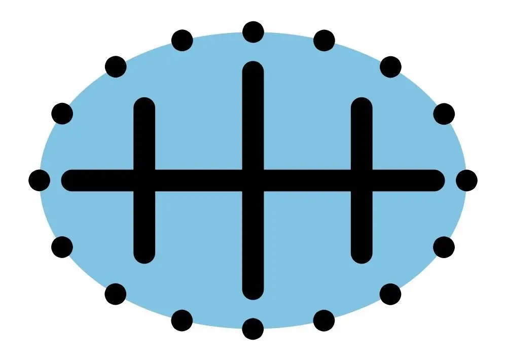 ECDIS standard symbol for a dangerous wreck, depth unknown.